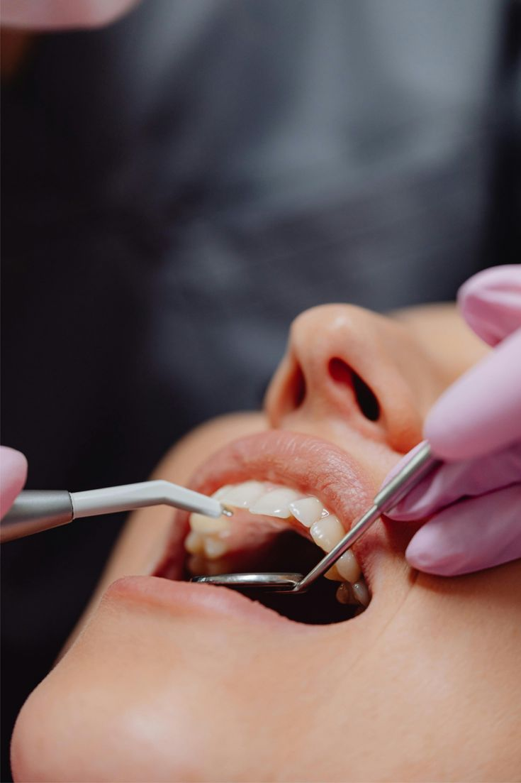 Odontologia Estética